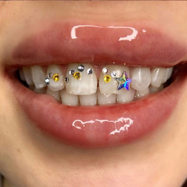 This $25 kit from Gemzeez gives you temporary tooth gems– here's how to  apply them
