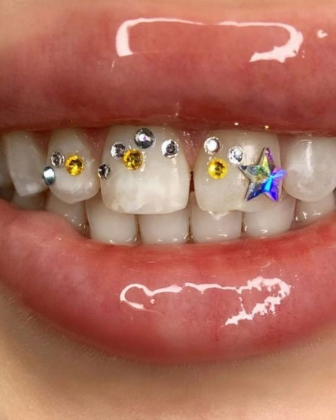 Starz Gemz Mega Pack – Gemzeez