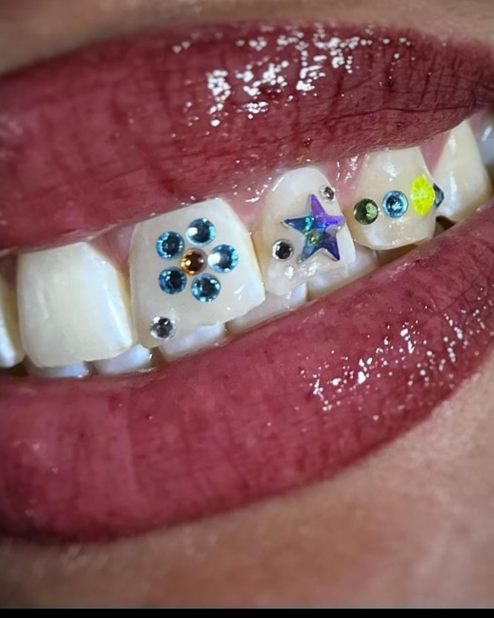 The Original DIY Temporary Tooth Gem Starter Kit – Gemzeez The Original DIY Temporary Tooth Gem Starter Kit – Gemzeez