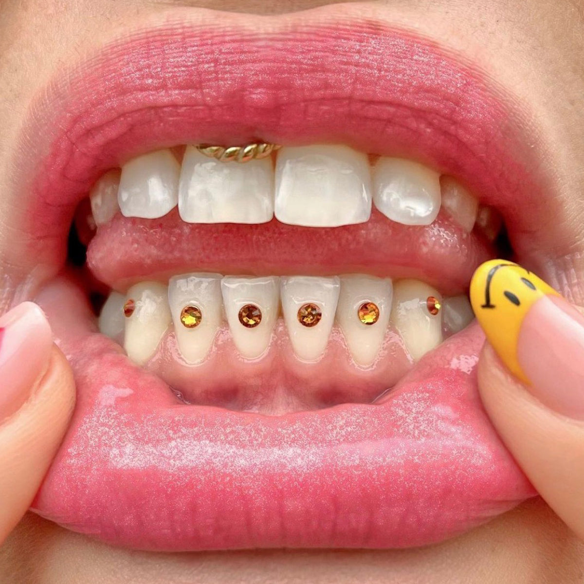 Model is wearing "All That Glitters Is Gold" on the bottom middle teeth and "Bumble Bee" on the surrounding bottom teeth.