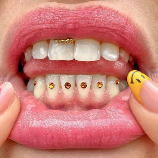 Model is wearing "All That Glitters Is Gold" on the bottom middle teeth and "Bumble Bee" on the surrounding bottom teeth.